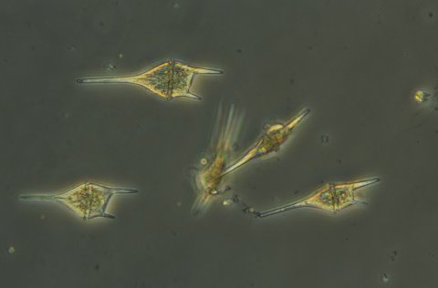 Creatium lineatum í sýni úr Reyðarfirði frá 15. september 2021. Myndin er tekin í gegnum smásjá með …